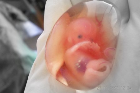 Фото - Искусственно созданные эмбрионы помогут установить причины не вынашиваемости беременности